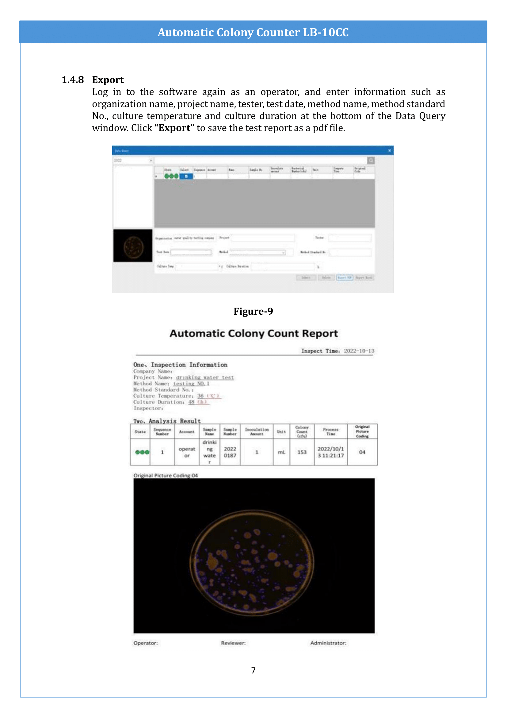 Automatic-Colony-Counter-LB-10CC-08.png