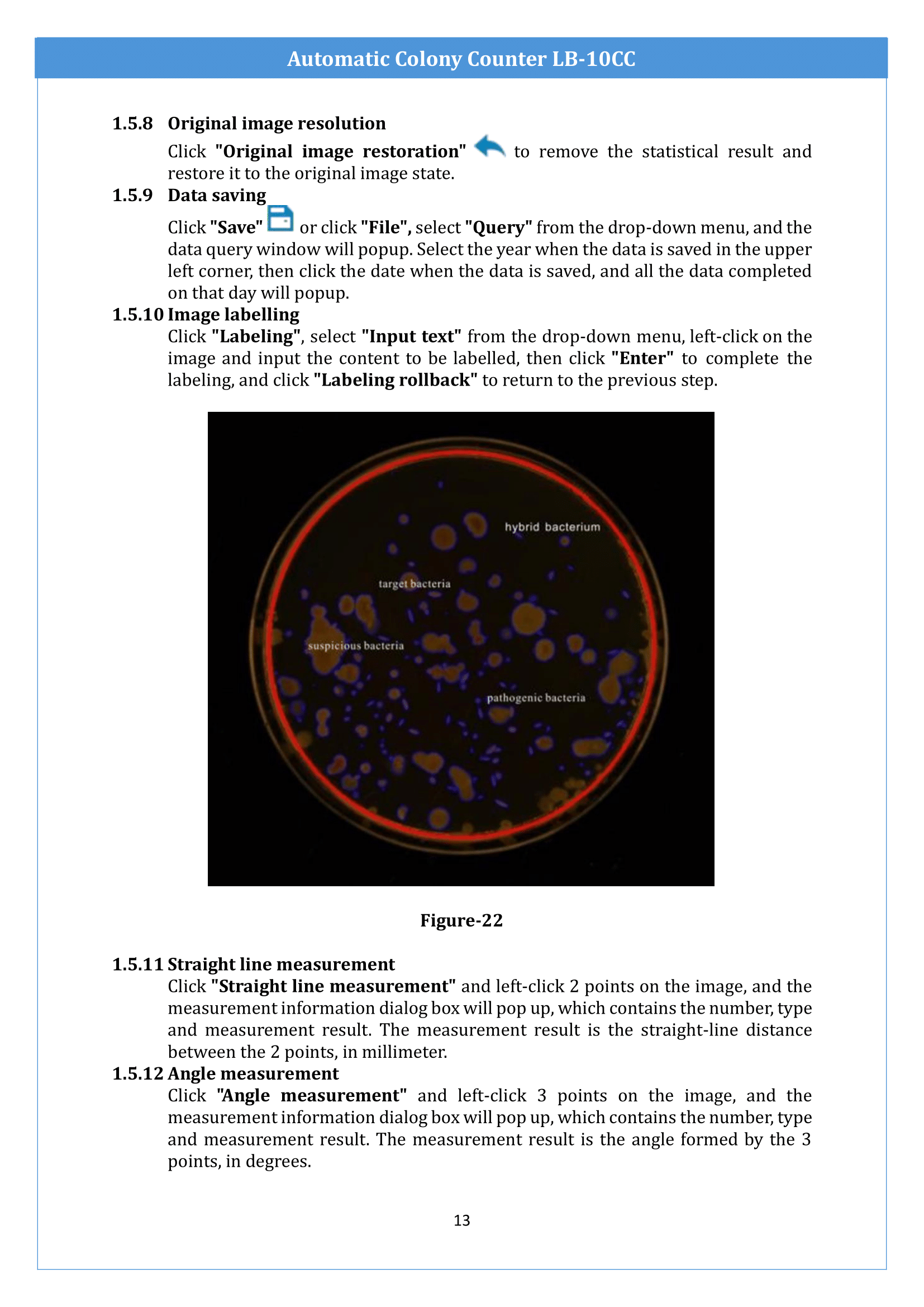 Automatic-Colony-Counter-LB-10CC-14.png
